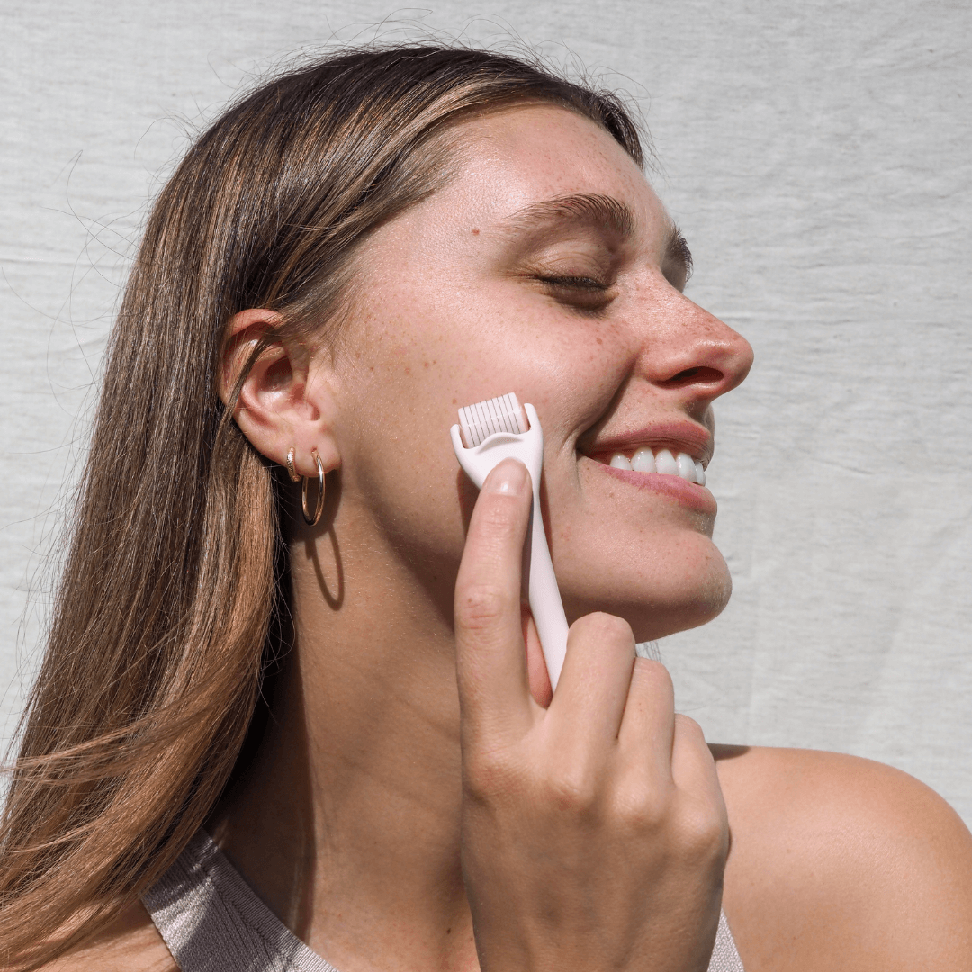 Acne Scars